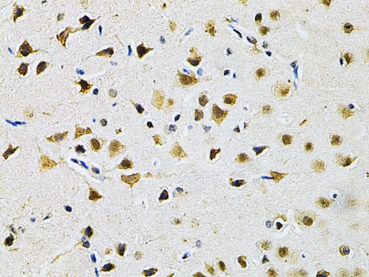 IHC-P analysis of rat brain tissue using GTX55633 Galectin 3 antibody. Dilution : 1:200