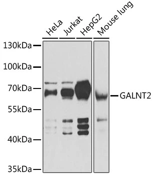 WB analysis of various sample lysates using GTX55634 GALNT2 antibody. Dilution : 1:1000 Loading : 25microg per lane WB analysis of various sample lysates using GTX55634 GALNT2 antibody. Dilution : 1:1000 Loading : 25microg per lane