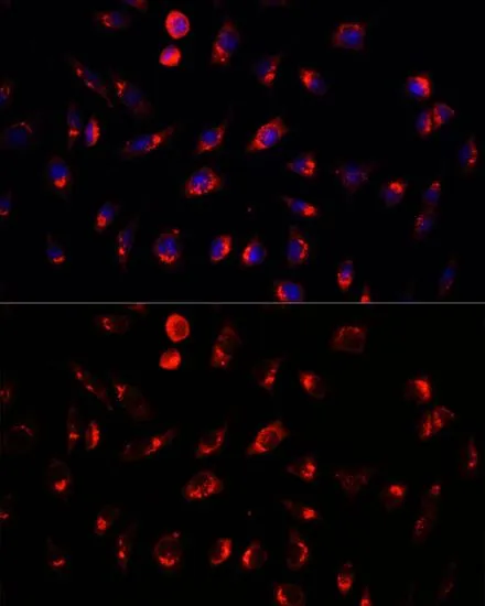 ICC/IF analysis of L929 cells using GTX55634 GALNT2 antibody. Blue : DAPI Dilution : 1:100