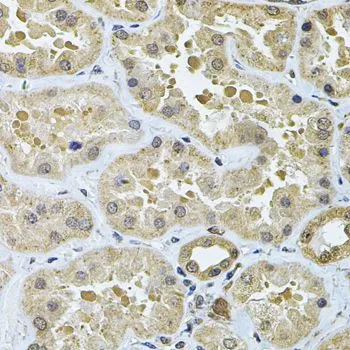 IHC-P analysis of human kidney tissue using GTX55634 GALNT2 antibody. Dilution : 1:100