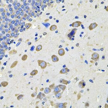 IHC-P analysis of rat brain tissue using GTX55634 GALNT2 antibody. Dilution : 1:100