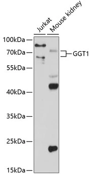 WB analysis of various sample lysates using GTX55638 GGT1 antibody. The signal was developed with ECL plus-Enhanced. Dilution : 1:1000 Loading : 25microg per lane WB analysis of various sample lysates using GTX55638 GGT1 antibody. The signal was developed with ECL plus-Enhanced. Dilution : 1:1000 Loading : 25microg per lane