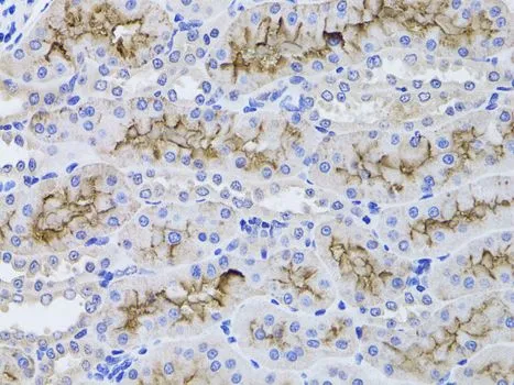 IHC-P analysis of rat kidney tissue using GTX55638 GGT1 antibody. Dilution : 1:100