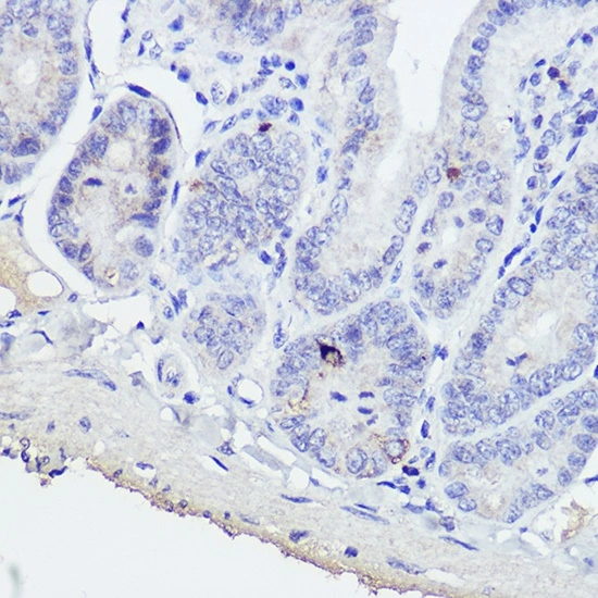 IHC-P analysis of mouse intestine tissue using GTX55639 GIP antibody. Antigen retrieval : 10 mM citrate buffer pH 6.0 Dilution : 1:50 IHC-P analysis of mouse intestine tissue using GTX55639 GIP antibody. Antigen retrieval : 10 mM citrate buffer pH 6.0 Dilution : 1:50