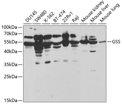 WB analysis of various samples using GTX55641 GSS antibody. Dilution : 1:1000 Loading : 25ug per lane