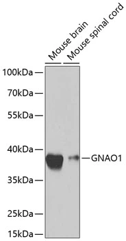 WB analysis of various sample lysates using GTX55644 GNAO1 antibody. Dilution : 1:1000 Loading : 25microg per lane