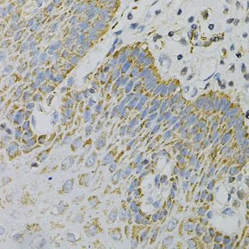 IHC-P analysis of human esophagus tissue using GTX55644 GNAO1 antibody. Dilution : 1:100