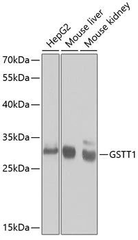 WB analysis of various sample lysates using GTX55652 GSTT1 antibody. Dilution : 1:1000 Loading : 25microg per lane WB analysis of various sample lysates using GTX55652 GSTT1 antibody. Dilution : 1:1000 Loading : 25microg per lane