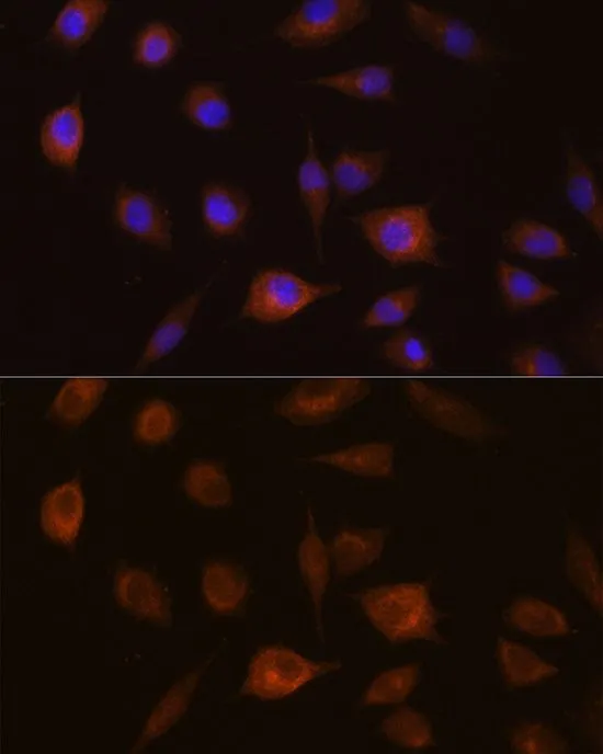 ICC/IF analysis of L929 cells using GTX55652 GSTT1 antibody. Blue : DAPI Dilution : 1:100