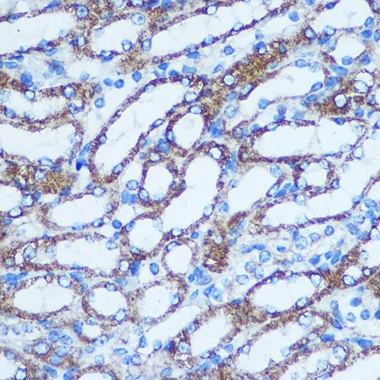 IHC-P analysis of mouse kidney tissue using GTX55652 GSTT1 antibody. Dilution : 1:100