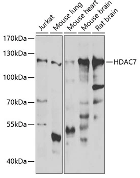 WB analysis of various sample lysates using GTX55655 HDAC7 antibody. The signal was developed with ECL plus-Enhanced. Dilution : 1:1000 Loading : 25microg per lane WB analysis of various sample lysates using GTX55655 HDAC7 antibody. The signal was developed with ECL plus-Enhanced. Dilution : 1:1000 Loading : 25microg per lane