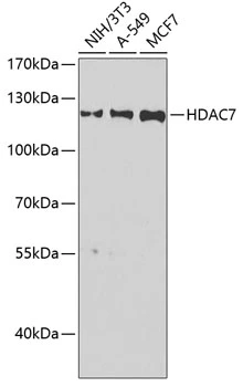 WB analysis of various sample lysates using GTX55655 HDAC7 antibody. Dilution : 1:1000 Loading : 25microg per lane