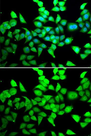 ICC/IF analysis of MCF7 cells using GTX55655 HDAC7 antibody. Blue : DAPI