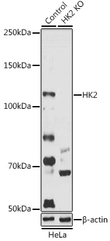 WB analysis of normal (control) and knockout (KO) HeLa cell lysate using GTX55657 Hexokinase II antibody. Dilution : 1:1000 Loading : 25microg per lane