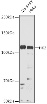 WB analysis of various sample lysates using GTX55657 Hexokinase II antibody. Dilution : 1:1000 Loading : 25microg per lane