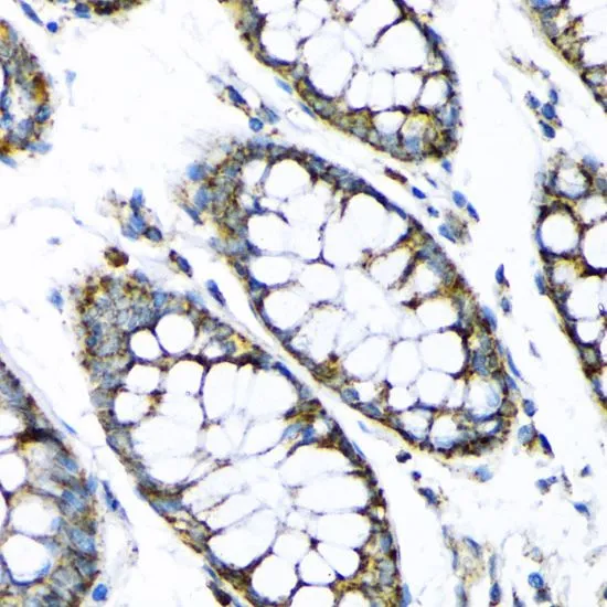 IHC-P analysis of human colon tissue using GTX55657 Hexokinase II antibody. Dilution : 1:200