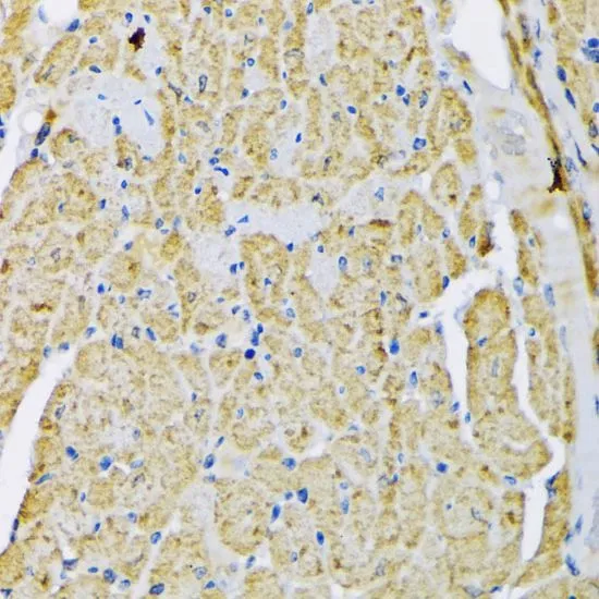 IHC-P analysis of mouse heart tissue using GTX55657 Hexokinase II antibody. Dilution : 1:200