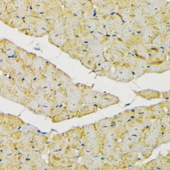 IHC-P analysis of rat heart tissue using GTX55657 Hexokinase II antibody. Dilution : 1:200