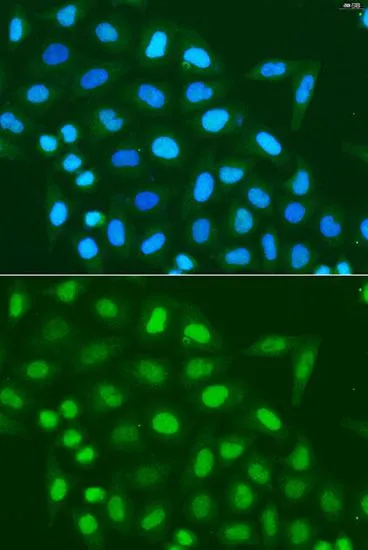 ICC/IF analysis of U2OS cells using GTX55659 Histone H3 antibody. Blue : DAPI Dilution : 1:100