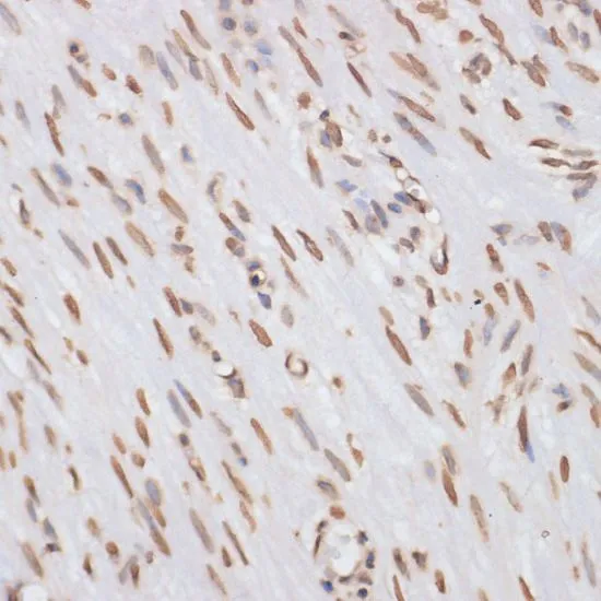IHC-P analysis of human appendix tissue using GTX55659 Histone H3 antibody. Dilution : 1:100