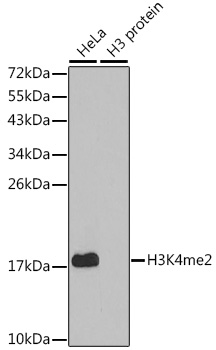IHC-P analysis of mouse brain tissue using GTX55660 Histone H3K4me2 (di-methyl Lys4) antibody. Dilution : 1:100