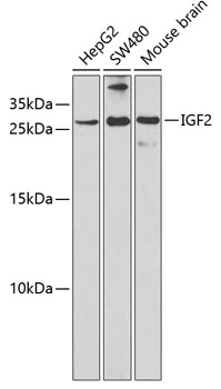 WB analysis of various sample lysates using GTX55671 IGF2 antibody. Dilution : 1:1000 Loading : 25microg per lane WB analysis of various sample lysates using GTX55671 IGF2 antibody. Dilution : 1:1000 Loading : 25microg per lane