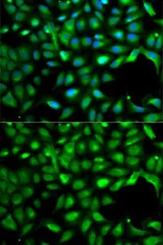 ICC/IF analysis of A549 cells using GTX55671 IGF2 antibody. Blue : DAPI