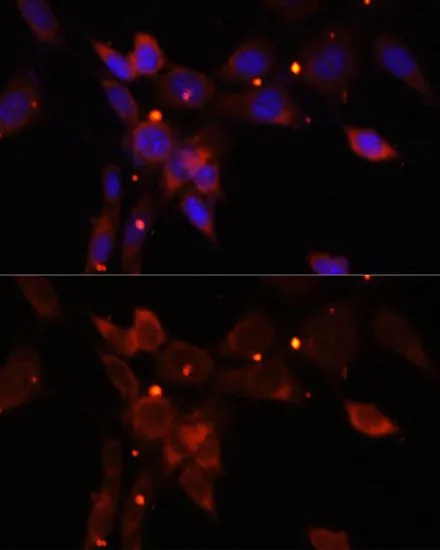 ICC/IF analysis of NIH/3T3 cells using GTX55673 IKK epsilon antibody. Blue : DAPI Dilution : 1:100