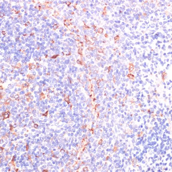 IHC-P analysis of rat spleen tissue using GTX55673 IKK epsilon antibody. Dilution : 1:200