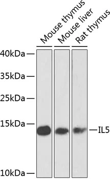 WB analysis of various sample lysates using GTX55678 IL5 antibody. The signal was developed with ECL plus-Enhanced. Dilution : 1:1000 Loading : 25microg per lane WB analysis of various sample lysates using GTX55678 IL5 antibody. The signal was developed with ECL plus-Enhanced. Dilution : 1:1000 Loading : 25microg per lane