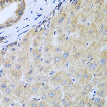 IHC-P analysis of human liver tissue using GTX55678 IL5 antibody. Dilution : 1:100