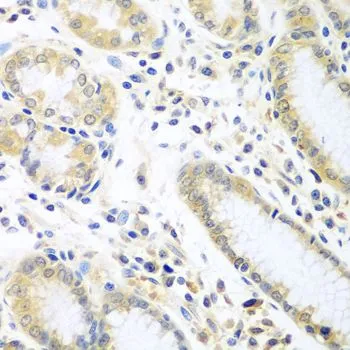 IHC-P analysis of human stomach tissue using GTX55678 IL5 antibody. Dilution : 1:100