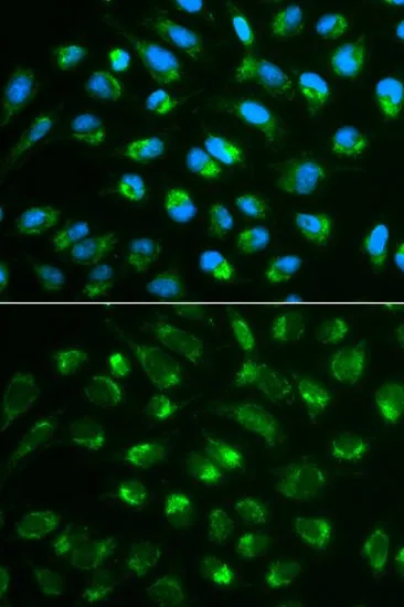 ICC/IF analysis of MCF7 cells using GTX55679 IL7 antibody. Blue : DAPI
