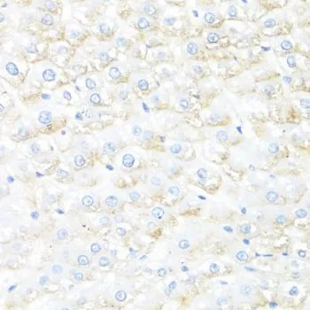 IHC-P analysis of rat liver tissue using GTX55679 IL7 antibody. Dilution : 1:100