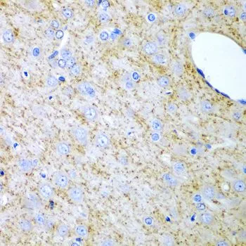IHC-P analysis of rat brain tissue using GTX55680 Inhibin alpha antibody. Dilution : 1:200