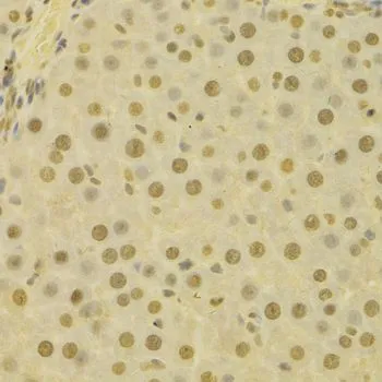 IHC-P analysis of human liver tissue using GTX55683 Jab1 antibody. Dilution : 1:100