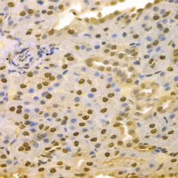 IHC-P analysis of rat kidney tissue using GTX55683 Jab1 antibody. Dilution : 1:100