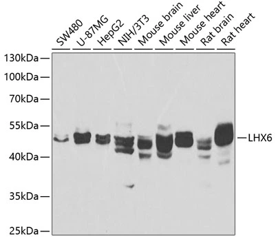 WB analysis of various sample lysates using GTX55690 LHX6 antibody. The signal was developed with ECL plus-Enhanced. Dilution : 1:1000 Loading : 25microg per lane WB analysis of various sample lysates using GTX55690 LHX6 antibody. The signal was developed with ECL plus-Enhanced. Dilution : 1:1000 Loading : 25microg per lane