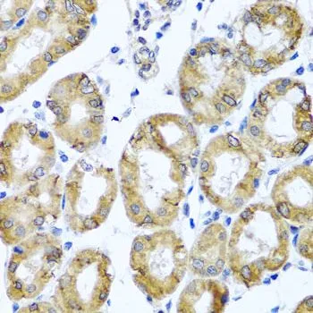 IHC-P analysis of human stomach tissue using GTX55693 M6PR (cation dependent) antibody. Dilution : 1:100