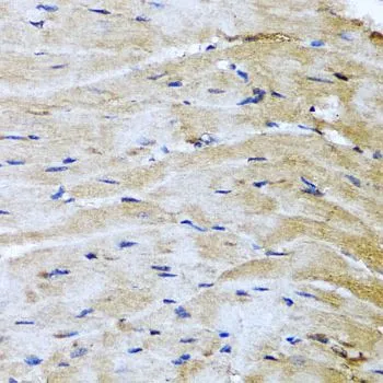 IHC-P analysis of mouse heart tissue using GTX55693 M6PR (cation dependent) antibody. Dilution : 1:100