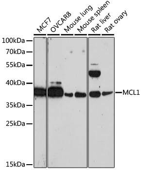 WB analysis of various sample lysates using GTX55698 MCL1 antibody. Dilution : 1:1000 Loading : 25microg per lane WB analysis of various sample lysates using GTX55698 MCL1 antibody. Dilution : 1:1000 Loading : 25microg per lane