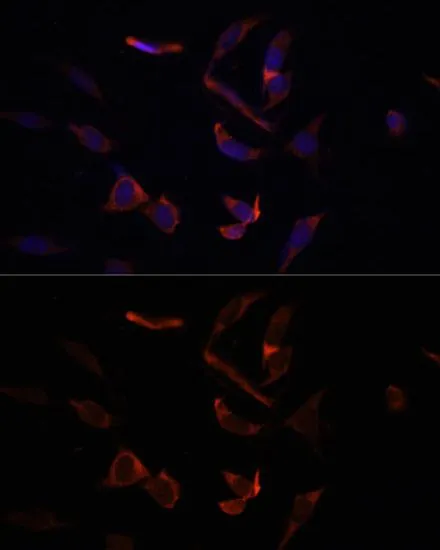 ICC/IF analysis of NIH/3T3 cells using GTX55698 MCL1 antibody. Blue : DAPI Dilution : 1:100