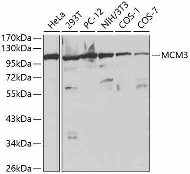 WB analysis of various sample lysates using GTX55699 MCM3 antibody. Dilution : 1:1000 Loading : 25microg per lane