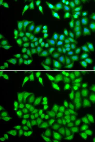 ICC/IF analysis of U2OS cells using GTX55699 MCM3 antibody. Blue : DAPI