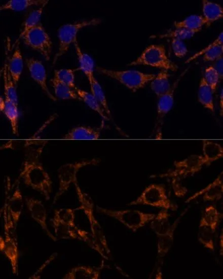ICC/IF analysis of HeLa cells using GTX55700 MDH2 antibody. Blue : DAPI Dilution : 1:100