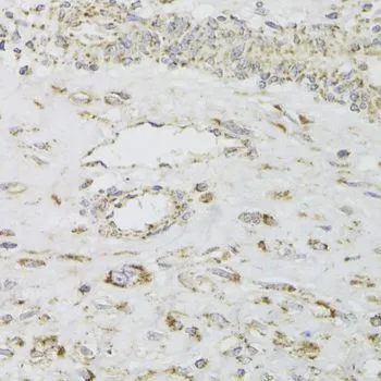 IHC-P analysis of human leiomyoma of uterus tissue using GTX55700 MDH2 antibody. Dilution : 1:100