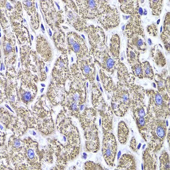 IHC-P analysis of human liver damage tissue using GTX55700 MDH2 antibody. Dilution : 1:100
