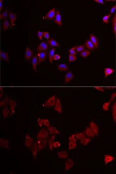 ICC/IF analysis of MCF7 cells using GTX55702 MEK5 antibody. Blue : DAPI