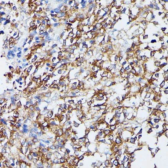IHC-P analysis of human appendix tissue using GTX55702 MEK5 antibody. Dilution : 1:100