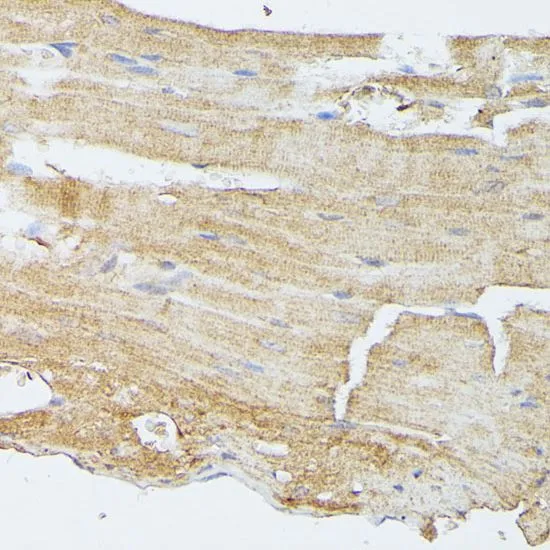 IHC-P analysis of mouse heart tissue using GTX55702 MEK5 antibody. Dilution : 1:100